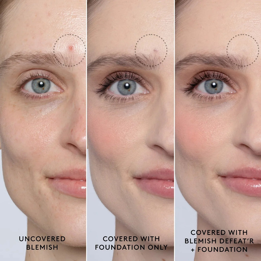 Gel Fenty Defeat'r Skin Blemish BHA Spot-Targeting