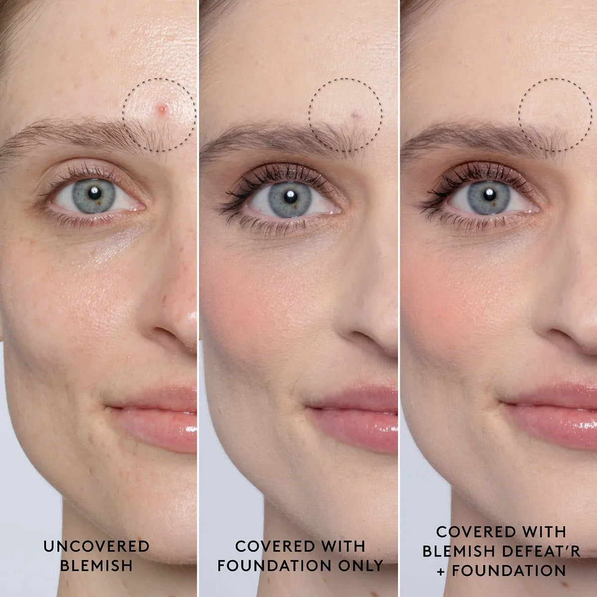 Gel Fenty Defeat'r Skin Blemish BHA Spot-Targeting