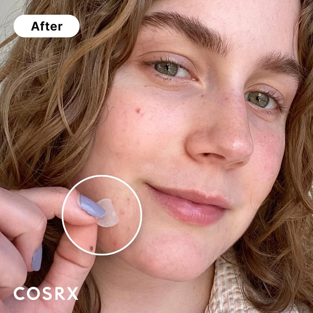 Body, Spot Toxic Absorbing Cosrx Count On For Stickers And Zits 3 Patches Tested No Blemishes Pimple For Ingredients Animals, Cover, Face dimension Hydrocolloid (Pack. Acne And Patch Not (240 Original