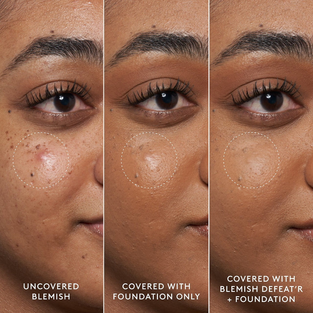 Gel Fenty Defeat'r Skin Blemish BHA Spot-Targeting
